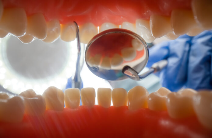 how to market dental implants